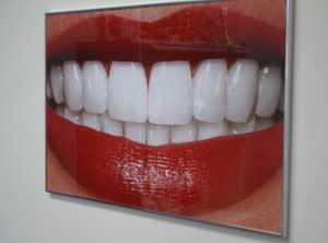 Teeth Whitening Poster